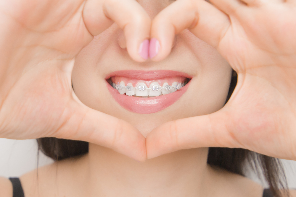 Orthodontic Dentistry  Corona, CA 